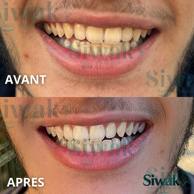 Dentifrice SiwakSmile 2.0 + BrushTimer
